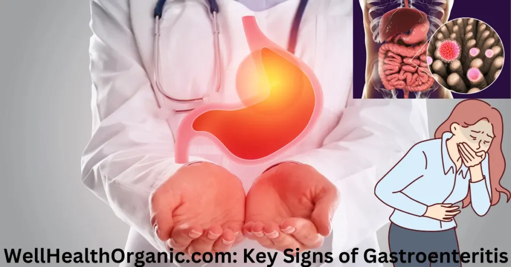WellHealthOrganic.com: Key Signs of Gastroenteritis Guide – Run Post WellHealthOrganic.com Key Signs of Gastroenteritis