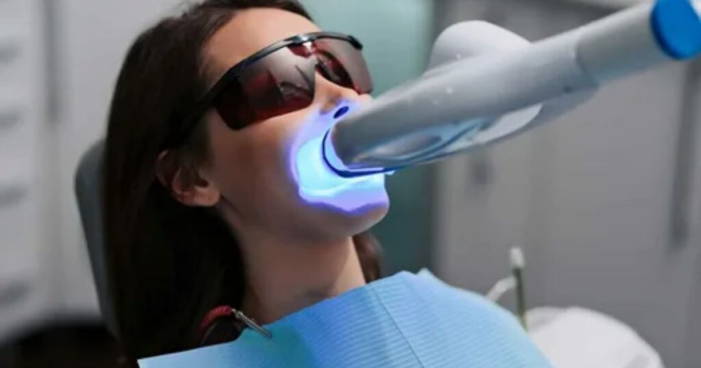 top-rated-teeth-whitening-clinics-in-huntington-beach